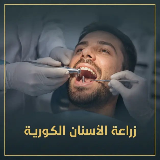 زراعة الأسنان الكورية