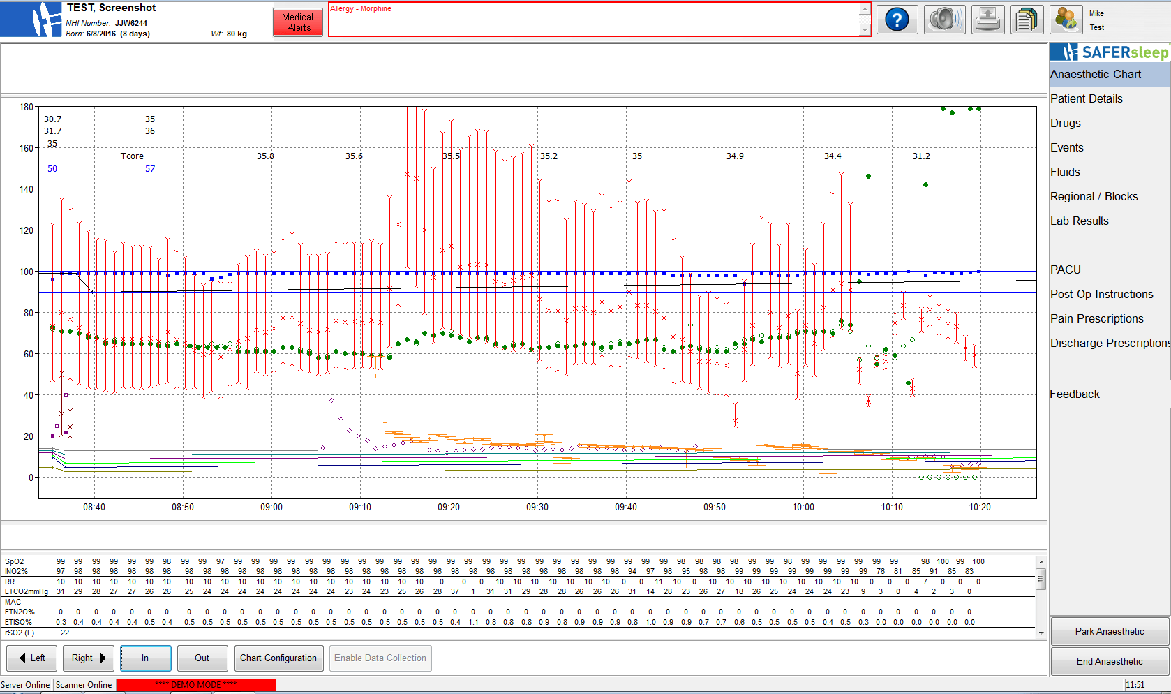 A screenshot of the SAFERsleep OR System Overview