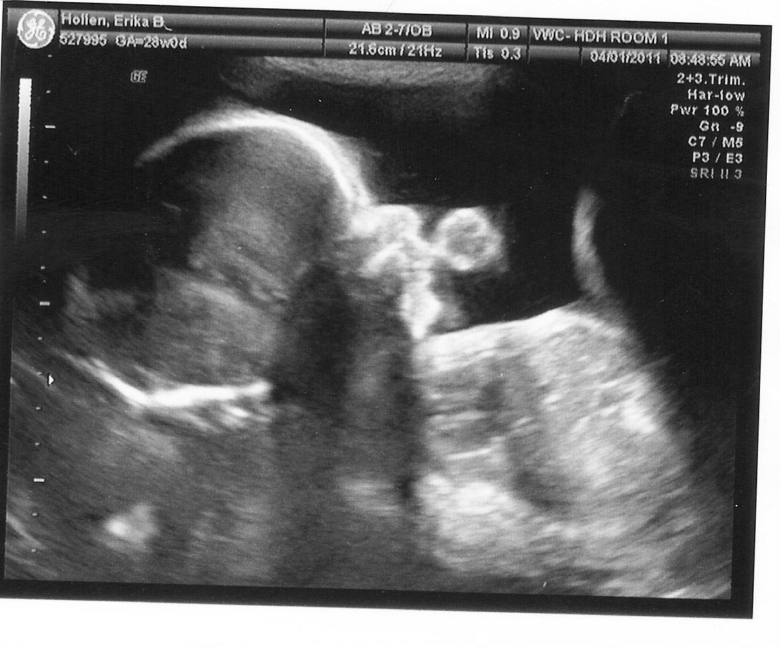 Erika Brent Sage & Zoo 28 weeks and counting!