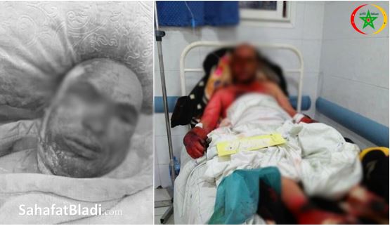 جريمة مروعة.. زوجة تحرق زوجها بطريقة متوحشة لهذا السبب