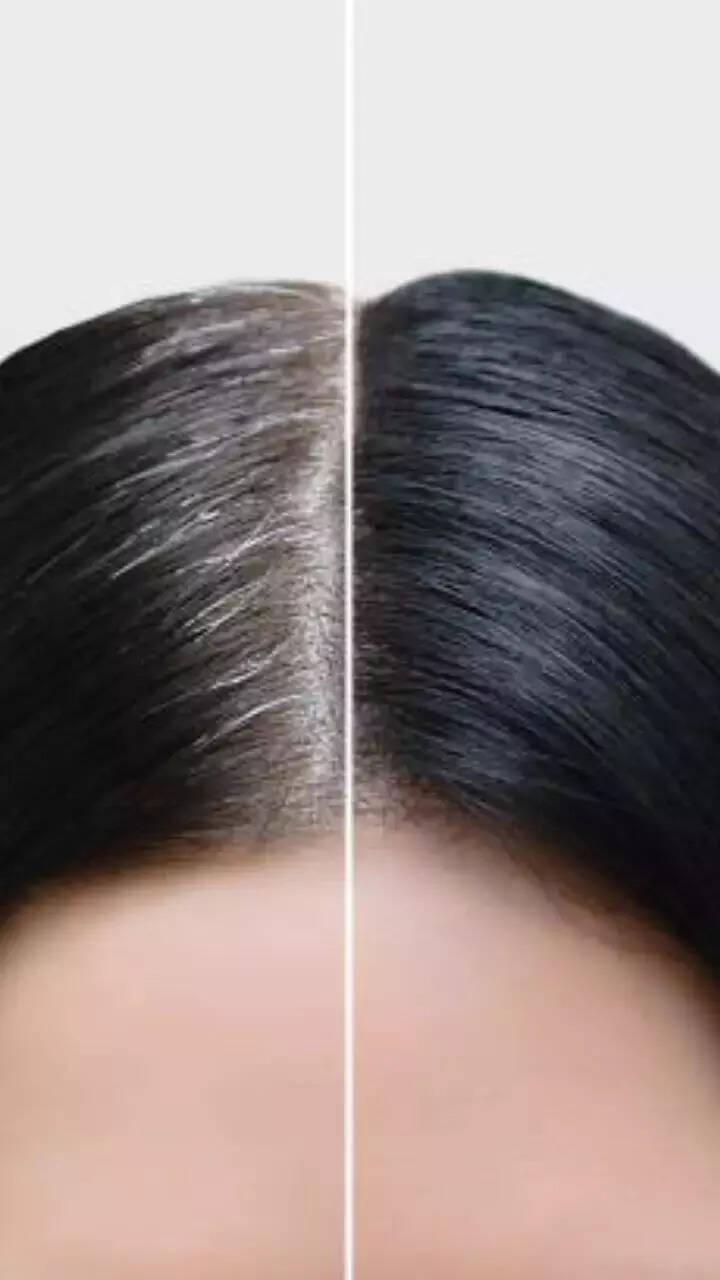 9 daily habits that can delay greying of hair 9 daily habits that can delay greying of hair