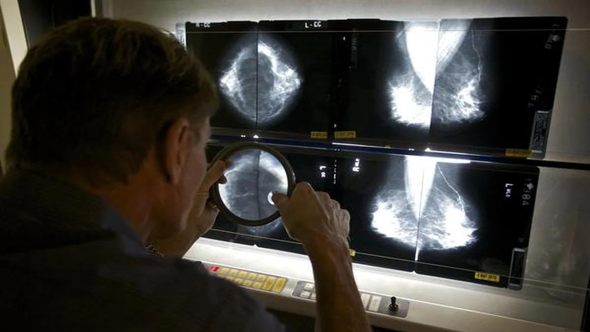 BREASTCANCERMENOPAUSEHORMONES