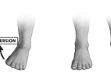 Ankle Inversion And Ankle Eversion Samarpan Physiotherapy Clinic