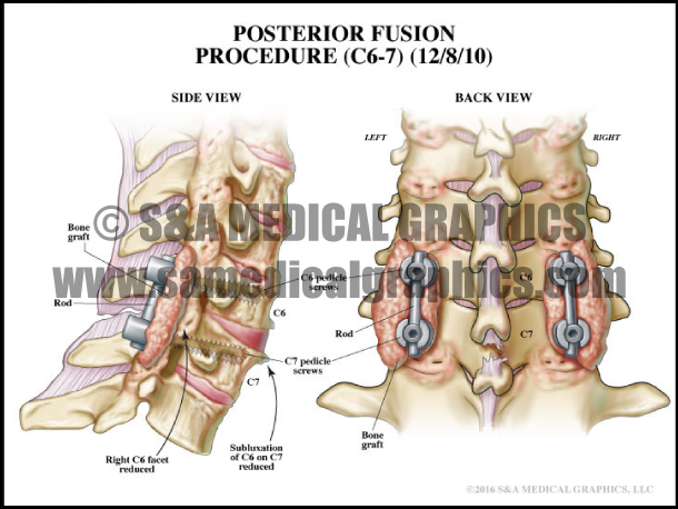 The human spine (vertebral column) with the name and description of all sites. Spine Surgery S A Medical Graphics