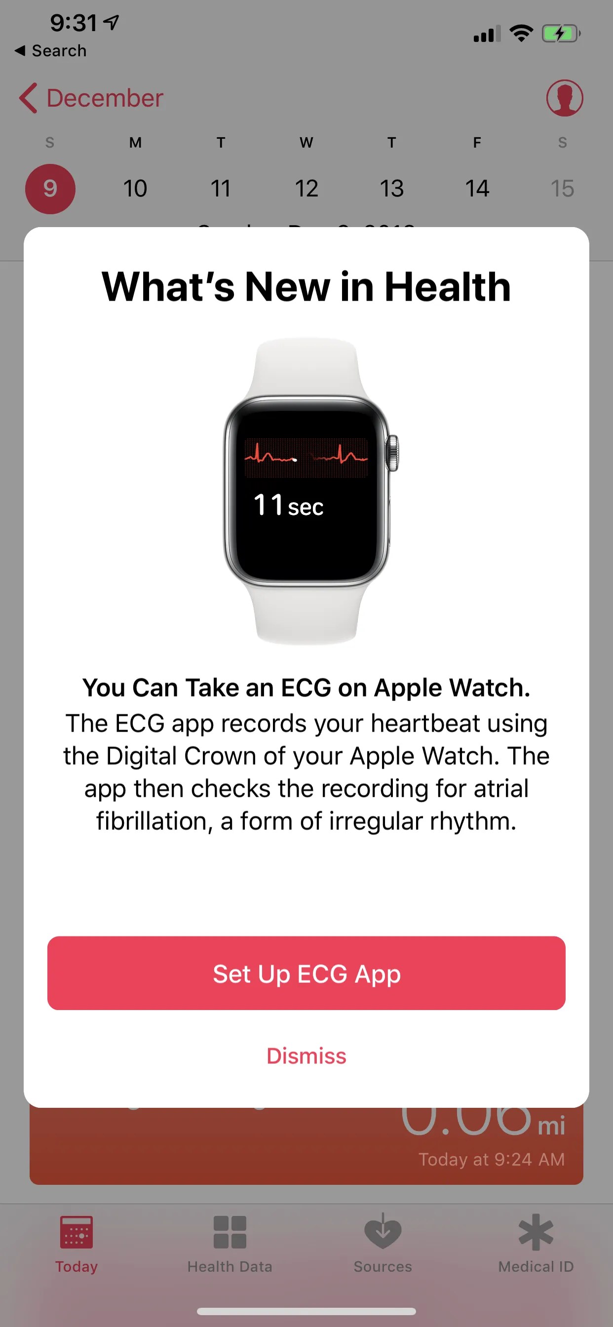 I just took an ECG on my Apple Watch