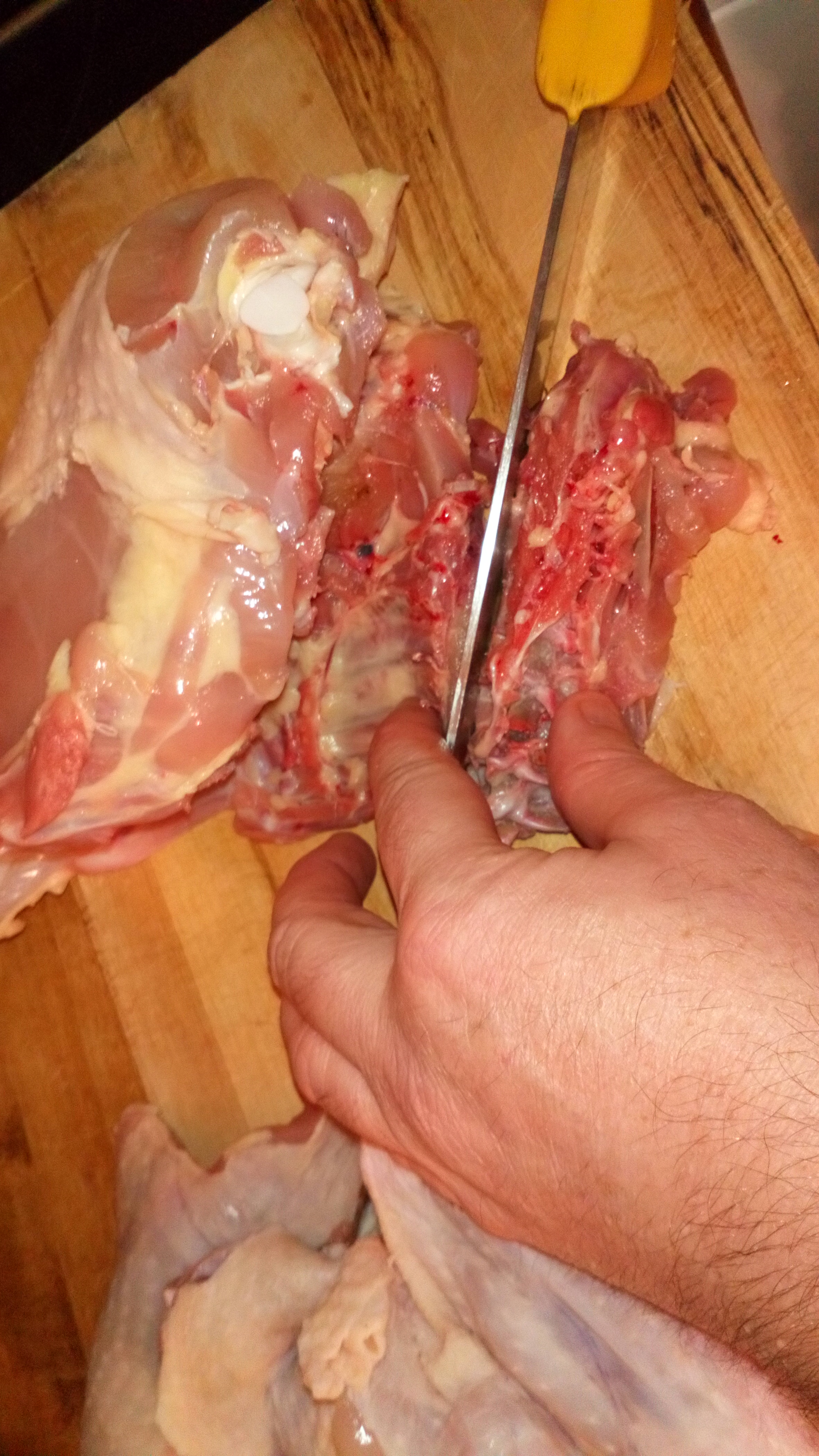 et la colonne vertébrale. And vertebral column