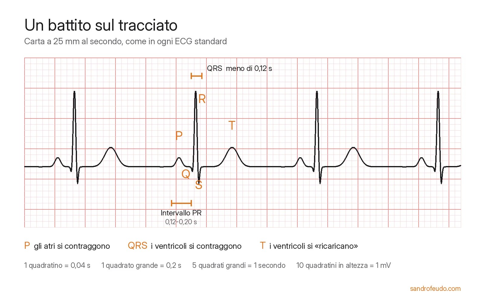 Tracciato ECG su carta rosa a quadretti con un battito evidenziato: onda P, complesso QRS con Q, R e S, onda T, intervallo PR