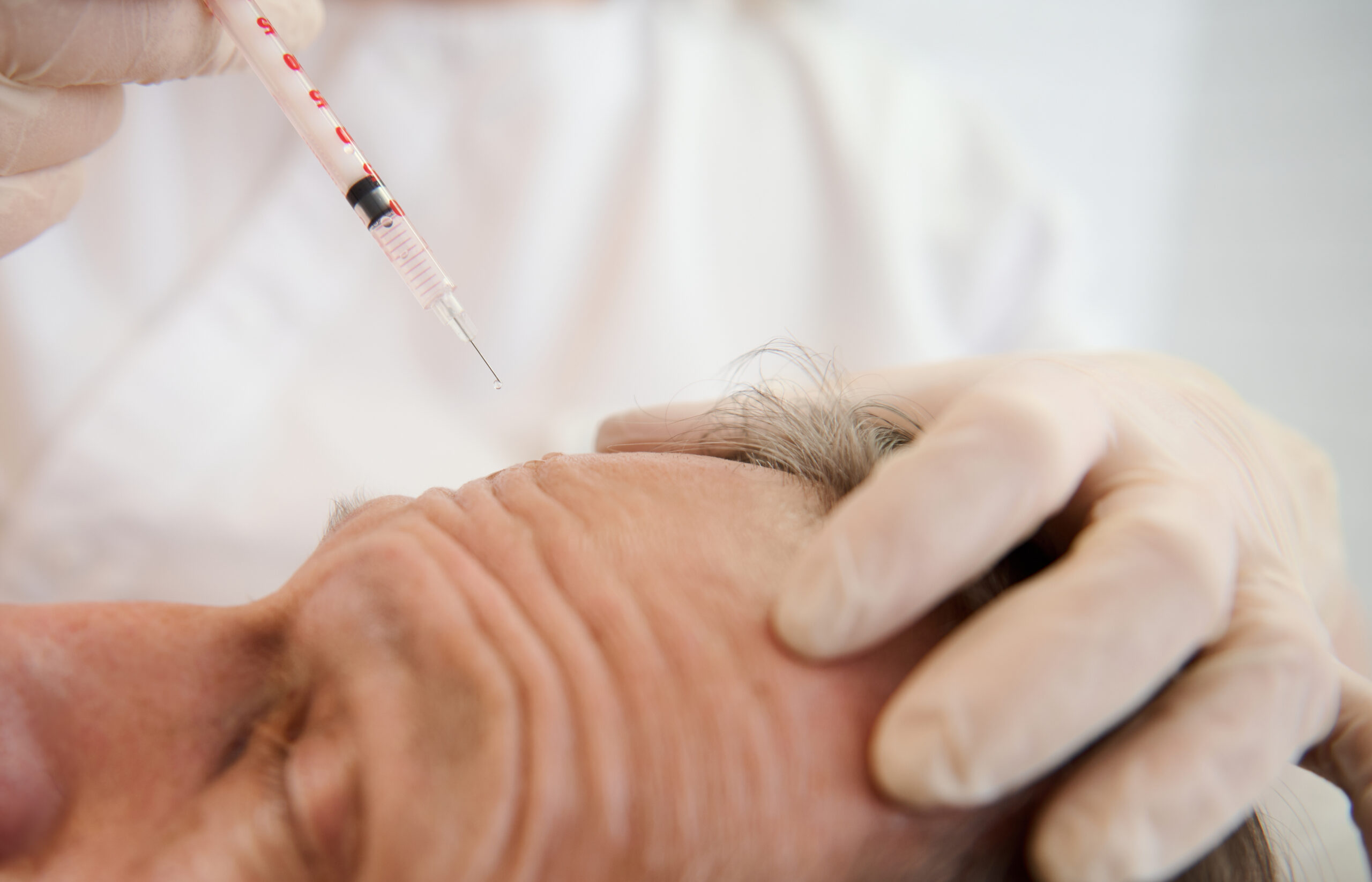 Anti aging skin care in Santa Cruz, neuromodulators