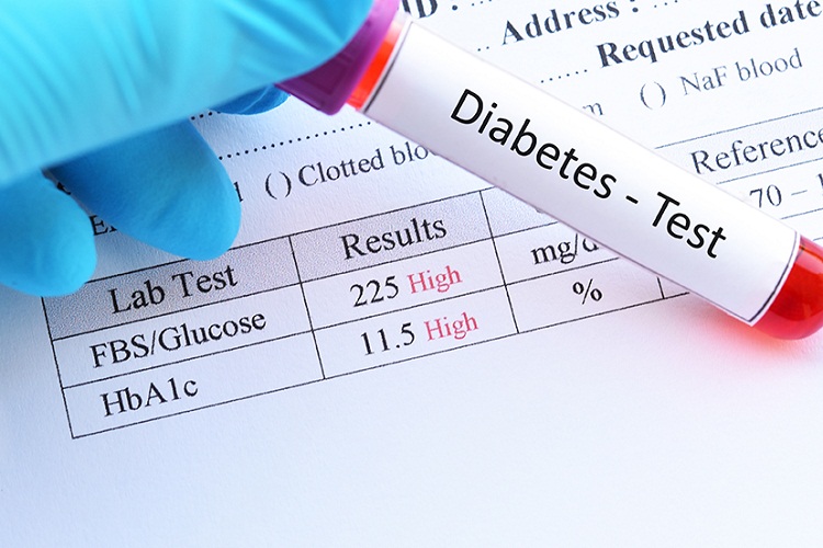 A Comprehensive Review of Diabetes Test