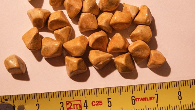 What are Different Type of Gall Stones?