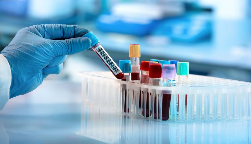 Technician holding blood tube test in the laboratory