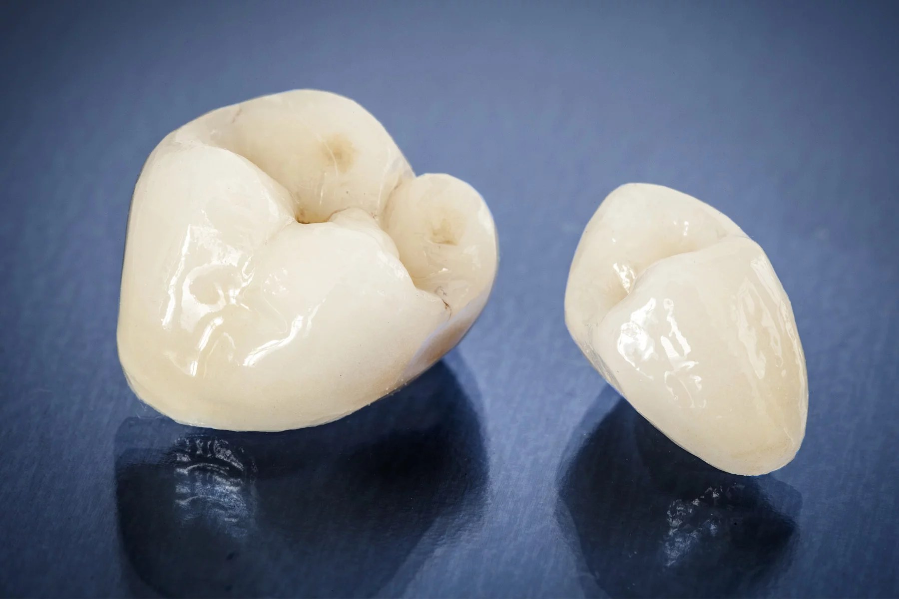 Kronen und brücken aus zirkonoxid