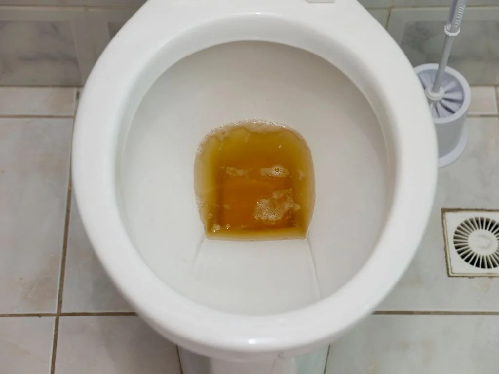 Simple Warning Sign in Your Urine That May Indicate Diabetes: What You