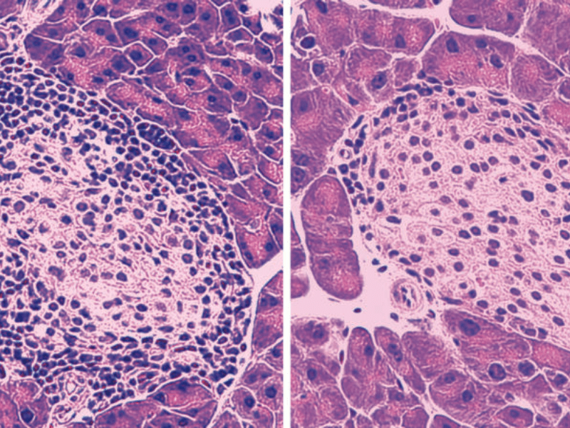 <strong>Mice Protected from Type 1 Diabetes Using Immune-Cell-Regulating Peptide</strong>