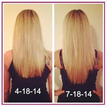 Before and After with Hairfinity vitamins Before and After with Hairfinity vitamins