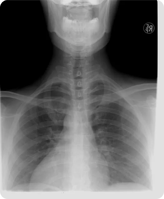 MRA와 MRI의 차이 이해하기