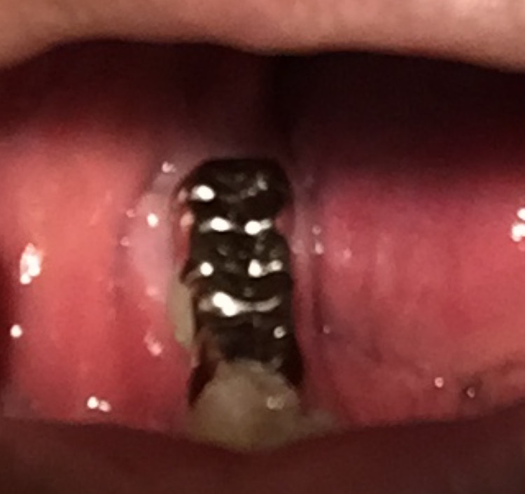 歯茎が腫れてる様だ！  理容室/Family Salon セイコウから