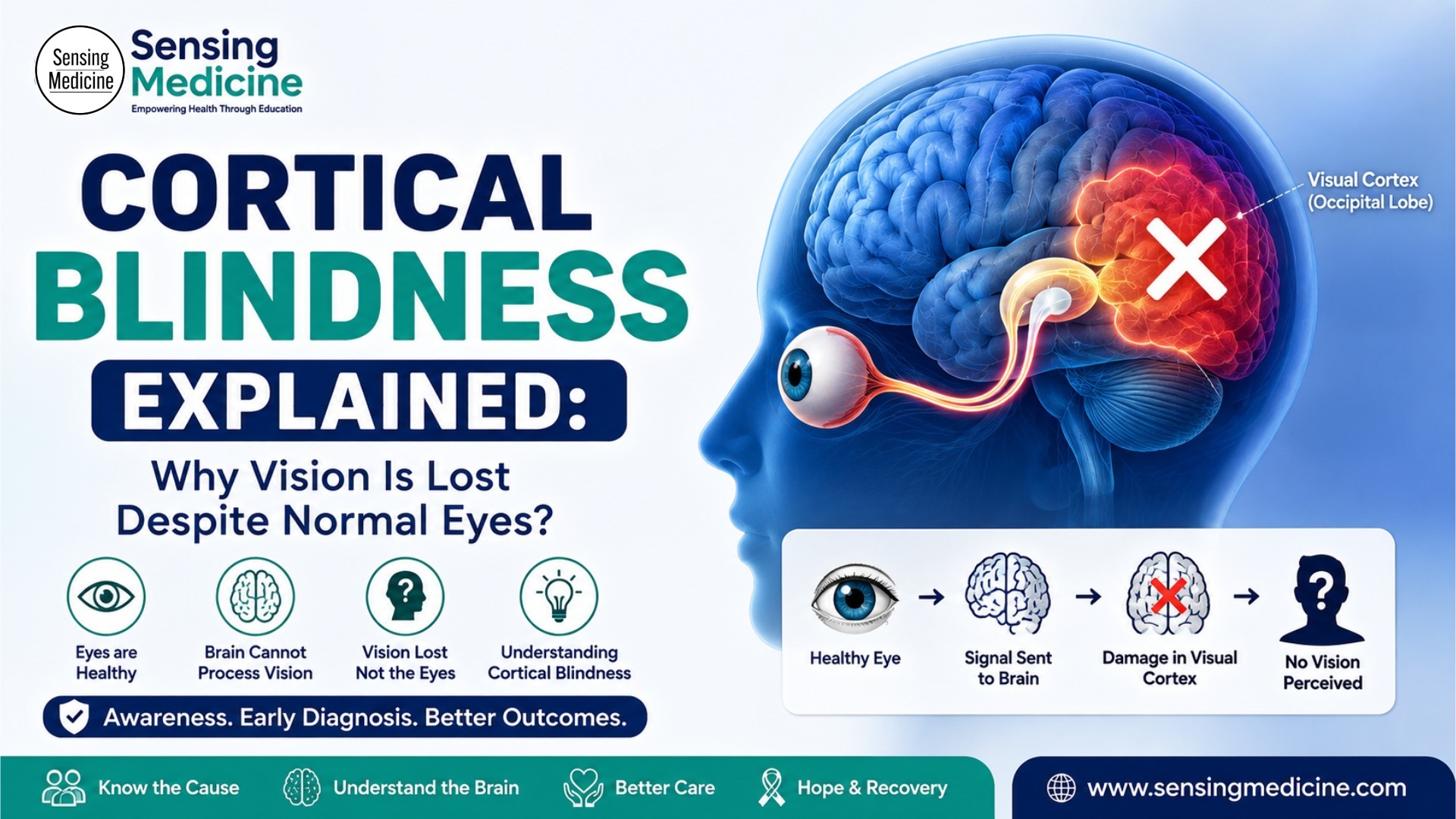 Cortical Blindness Explained Why Vision Is Lost Despite Normal Eyes