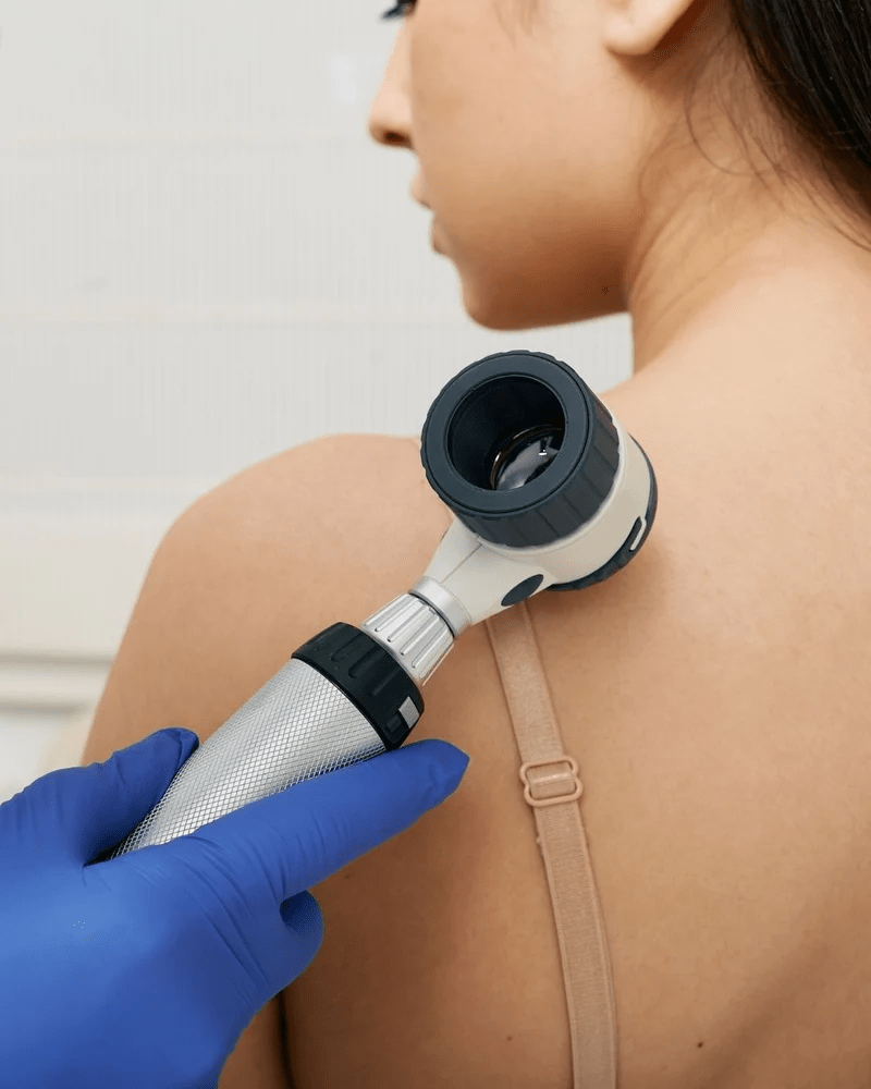 Skin cancer warning as weather warms