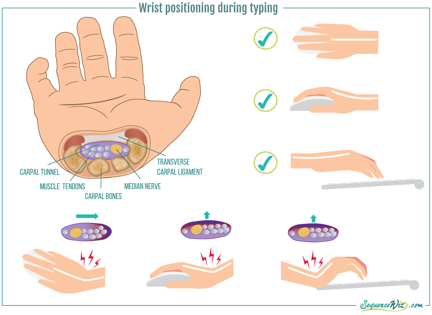 How To Prevent Wrist Pain Sequence Wiz 