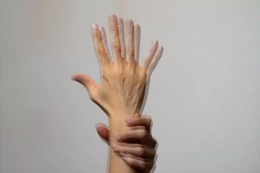 Parkinson
