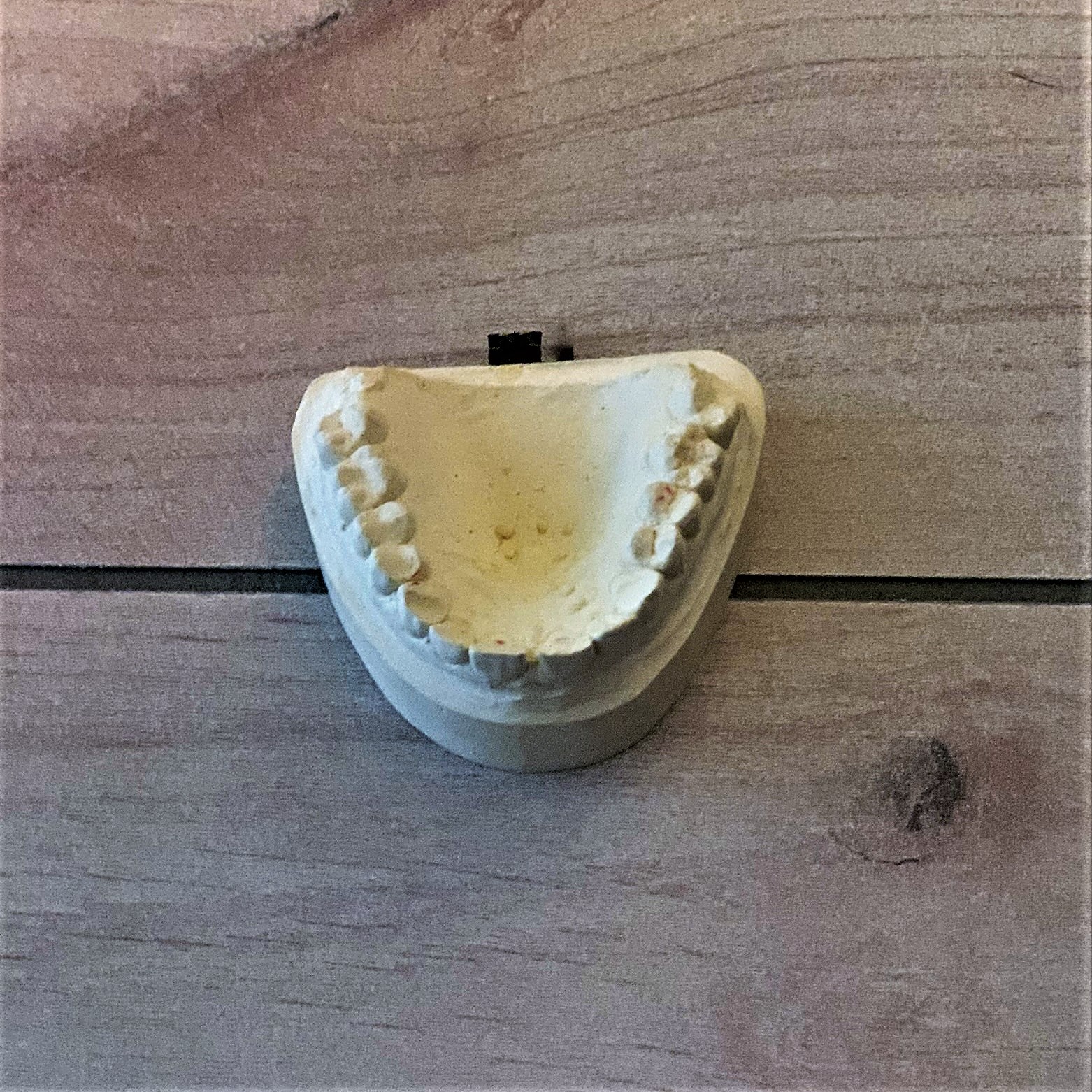 This is ideal model work. Not to big and not too small, just right.