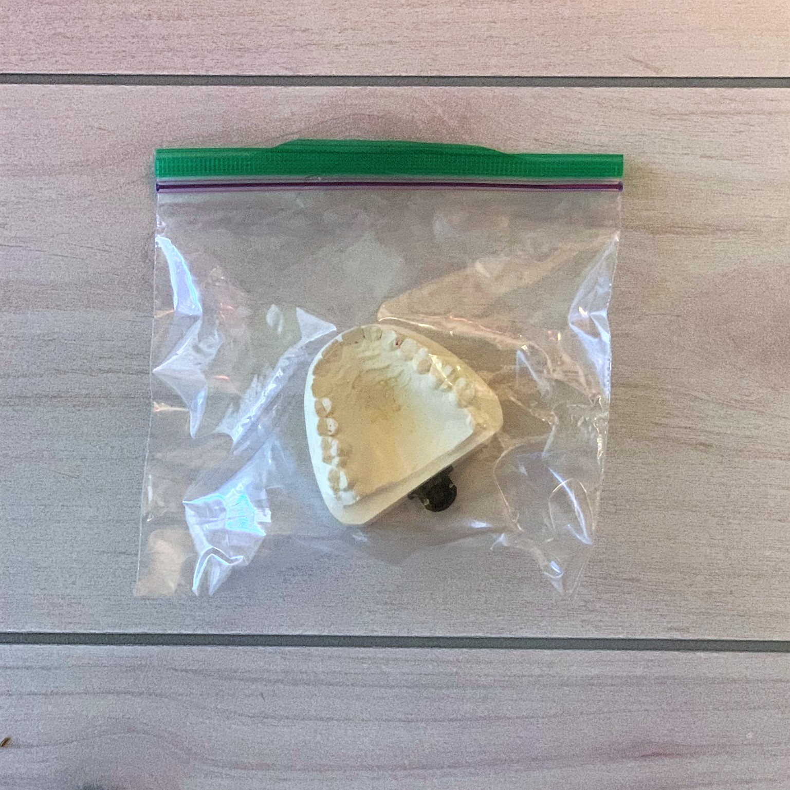 This model is unprotected and risks damage, especially to the cusps and incicals.