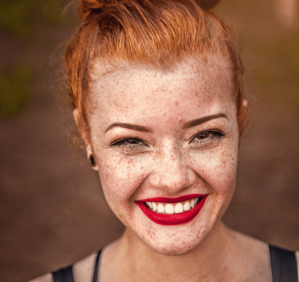 Sun Spots and Sun Damage