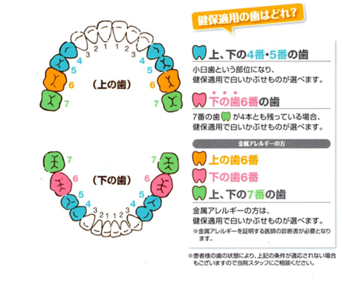 保険で白い歯に！？保険適用のcad/cam冠ってどんなもの？