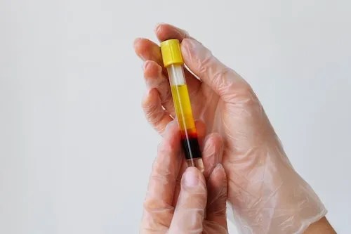 vitamin b12