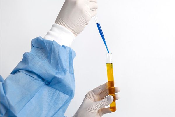 STD 14 Pathogen Test<br><div class="product-text">AED 399</div>