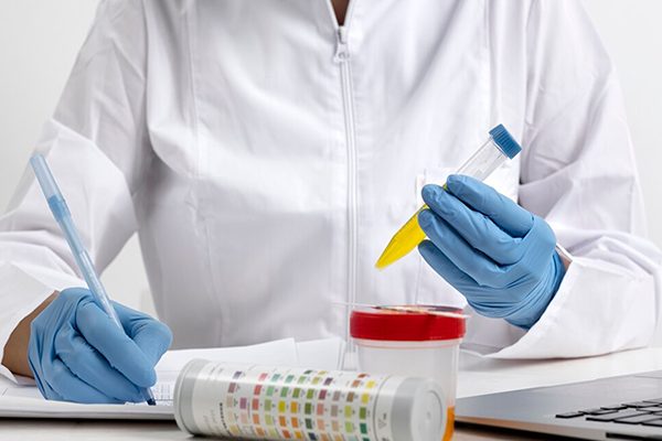 STD 28 Pathogen Test<br><div class="product-text">AED 699</div>