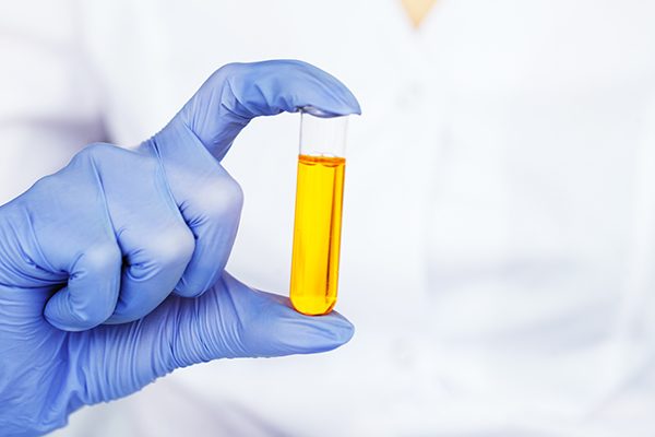 STD 5 Pathogen Test<br><div class="product-text">AED 199</div>