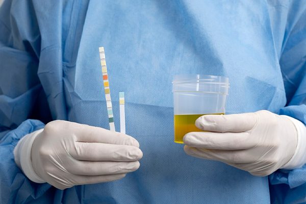 STD & UTI Screening - 40+ Pathogen Test<br><div class="product-text">AED 1299</div>