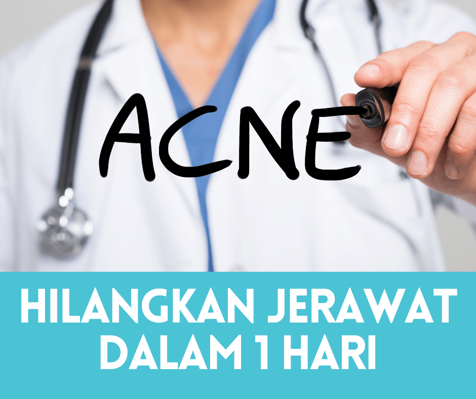 Berita baiknya, terdapat cara untuk menghilangkan parut . 3 Cara Nak Hilangkan Jerawat Dalam Masa 1 Hari 2022 Portal Kesihatan Anda