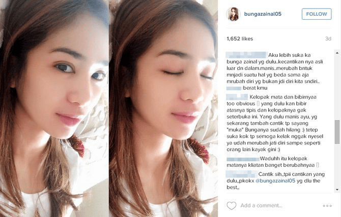 Dapatkan Gambar Mengenang Perubahan Wajah Tirus Cantik Bunga Zainal Yang Kini Terupdate oleh Lampung Hits