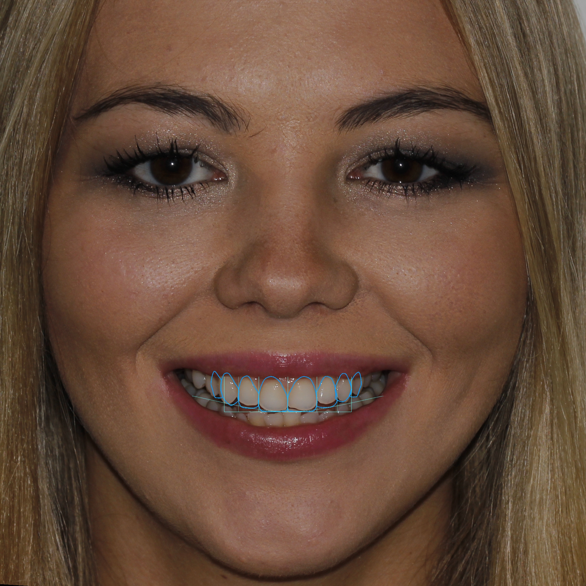 CORREÇÕES DIGITAIS