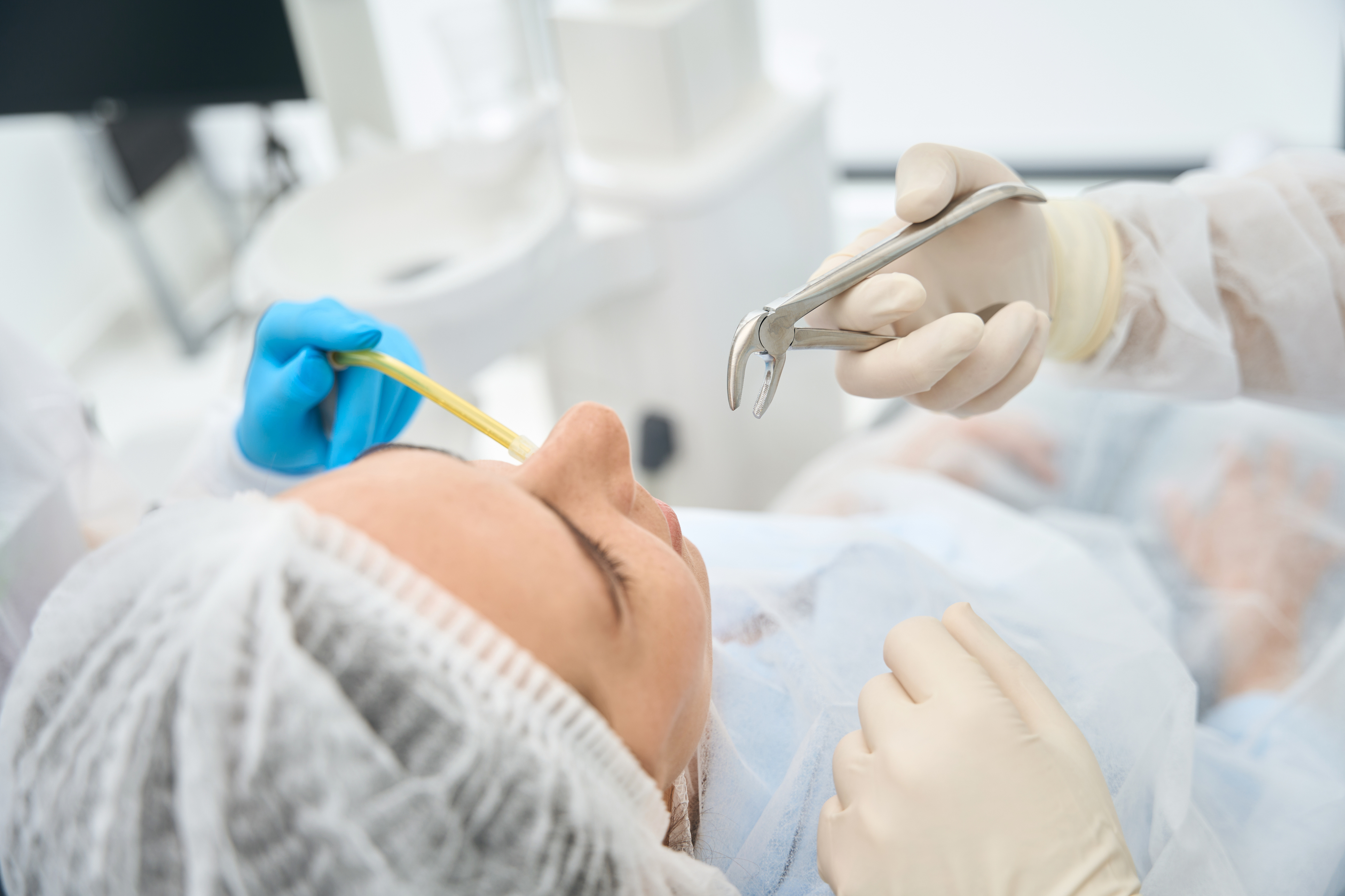 Tooth Extraction - Procedure
