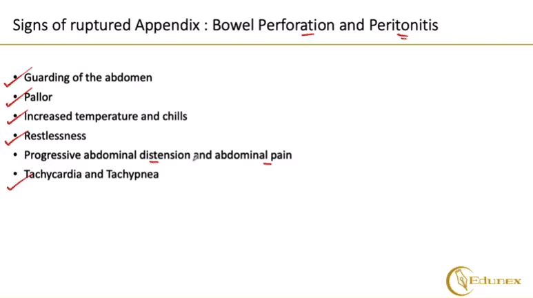 what caused an appendix to rupture - Ilustrasi 2