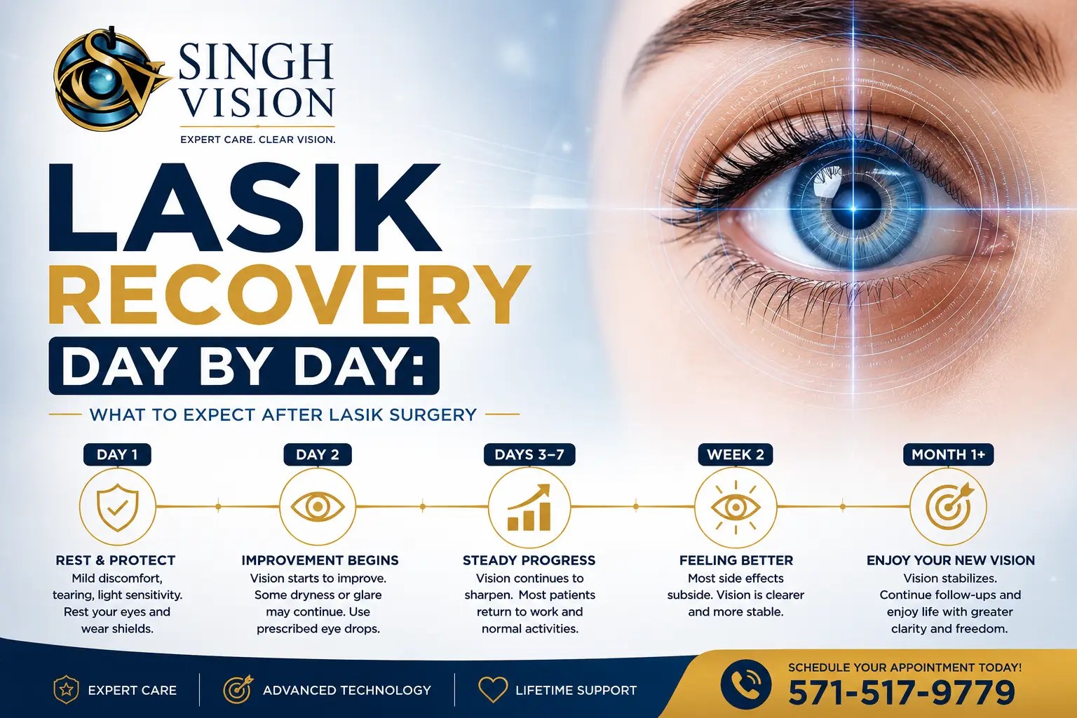 Lasik Recovery Day by Day