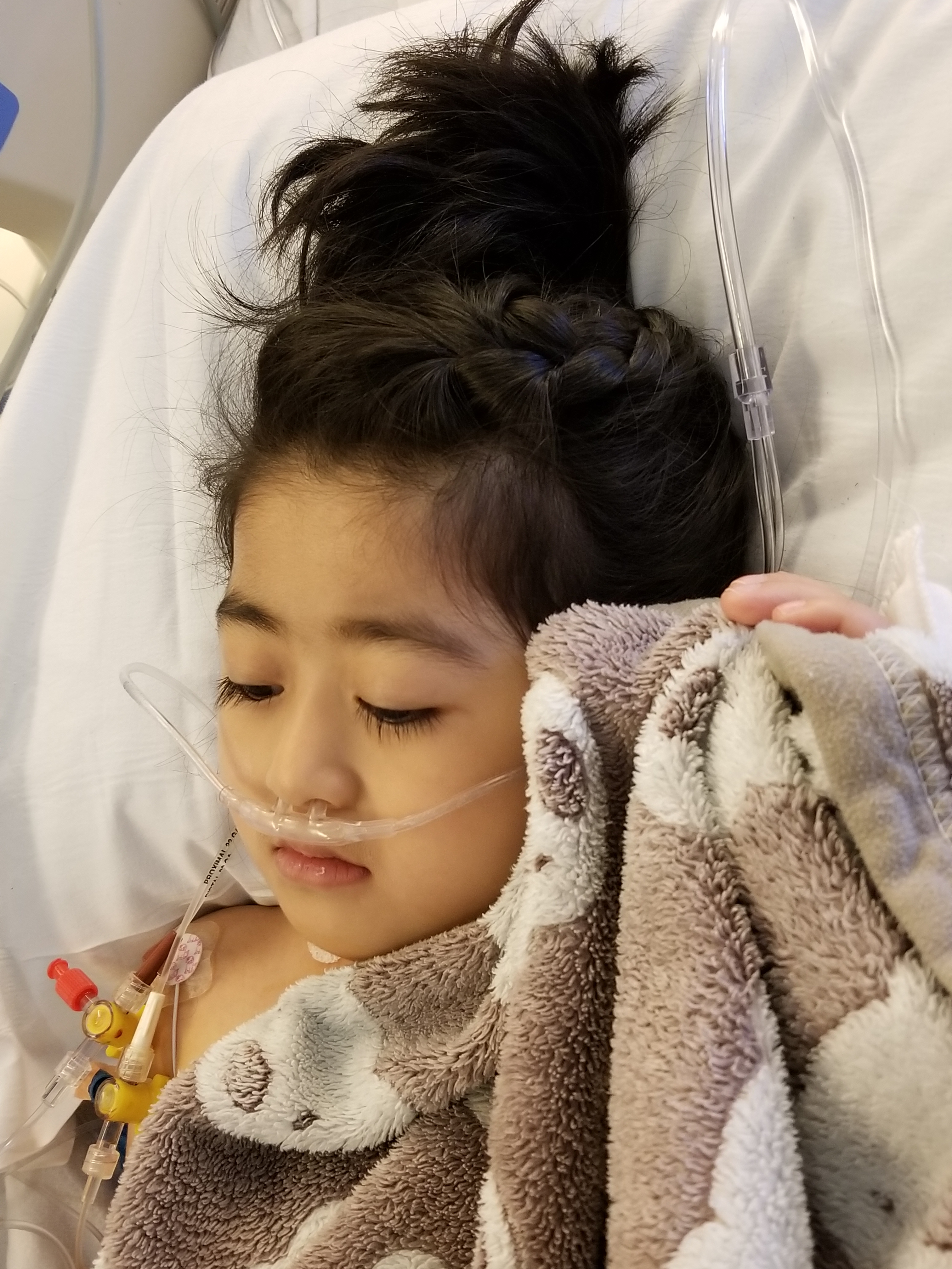 2nd day of recovery. Mommy washed her up and did her hair. 3 lines removed from her body. Everyday more will be removed.