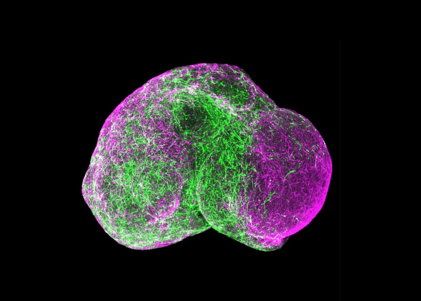 Mini Brains: Ethical Considerations of Growing Human Brain Organoids (2026)
