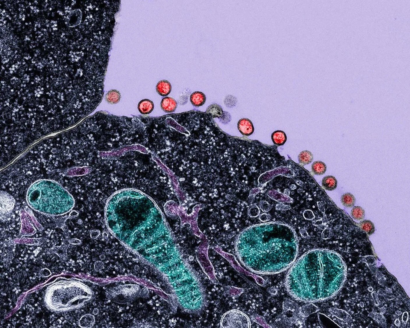 Breakthrough HIV Treatment: No More Daily Pills? | New Immunotherapy Explained (2026)