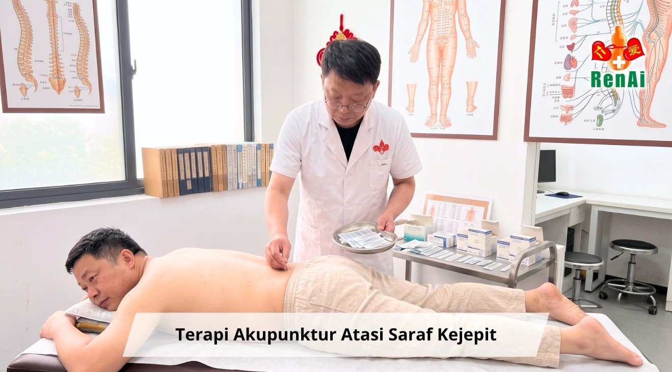 Terapi Akupunktur saraf kejepit