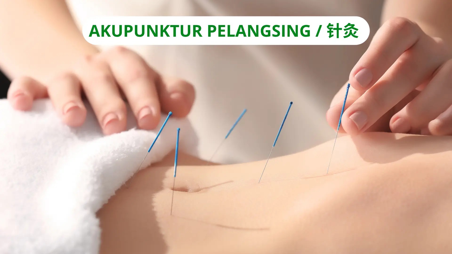 Akupunktur Pelangsing