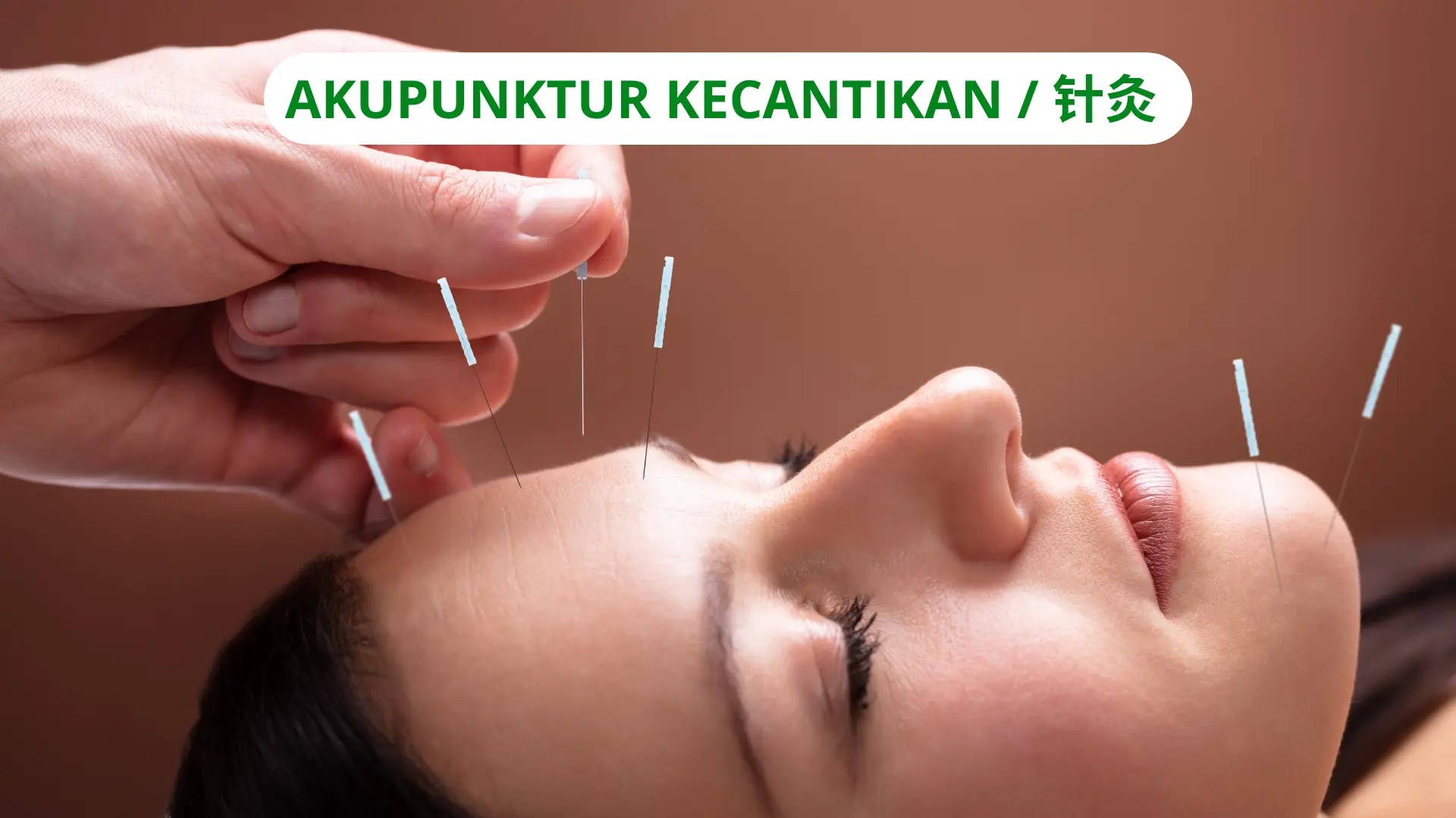 Akupunktur Kecantikan