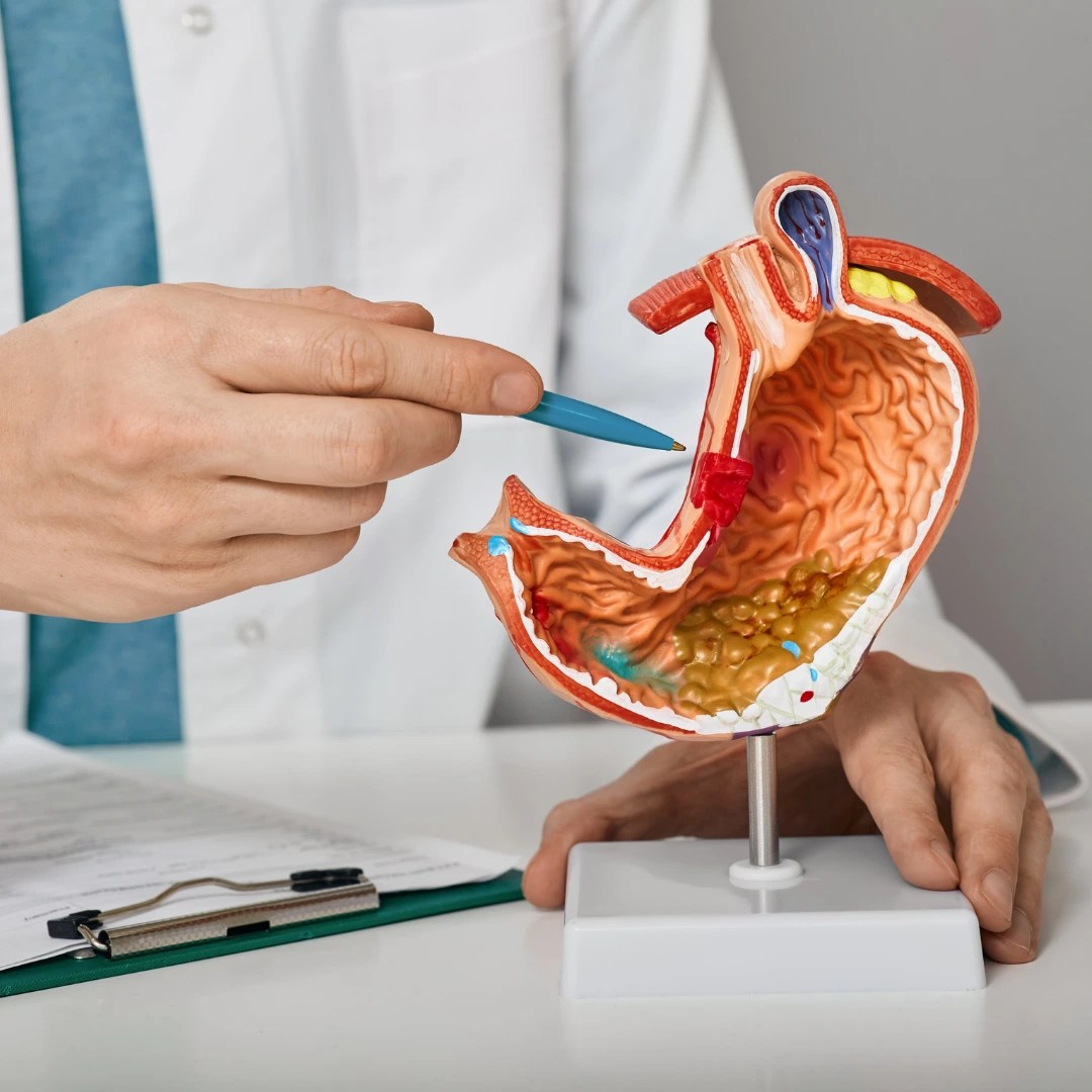 Gastritis