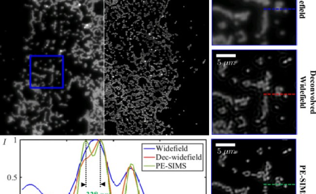 Structured Illumination Microscopy | Tian Lab