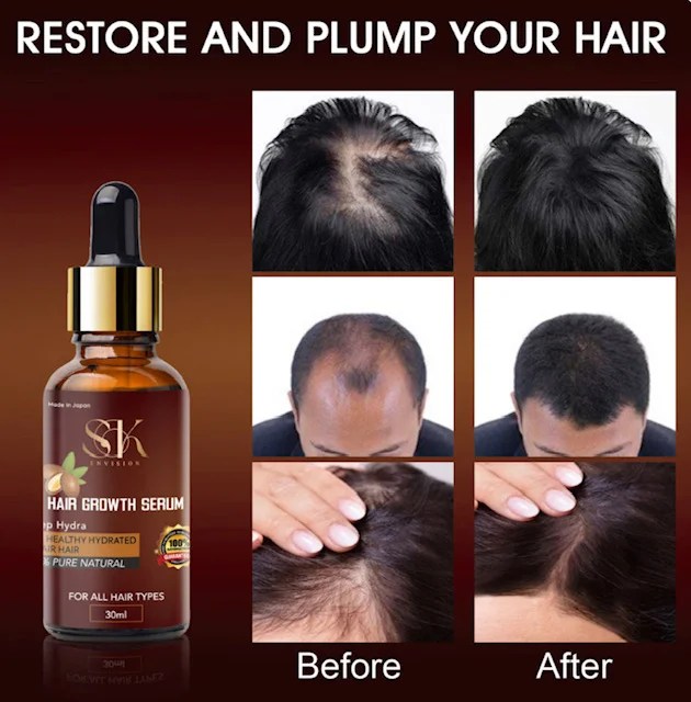 Hair Serum Regrowth of Hair extracted from Organic