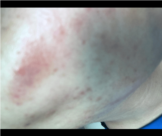 Sep 17, 2021 · spa sciences mio diamond. Microderm GLO Diamond Microdermabrasion [Effective or not